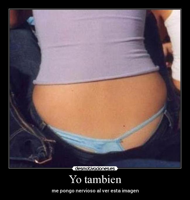 Yo tambien -