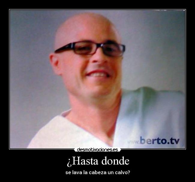 ¿Hasta donde - se lava la cabeza un calvo?