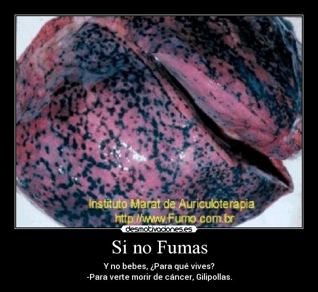 Si no Fumas - Y no bebes, ¿Para qué vives?
-Para verte morir de cáncer, Gilipollas.