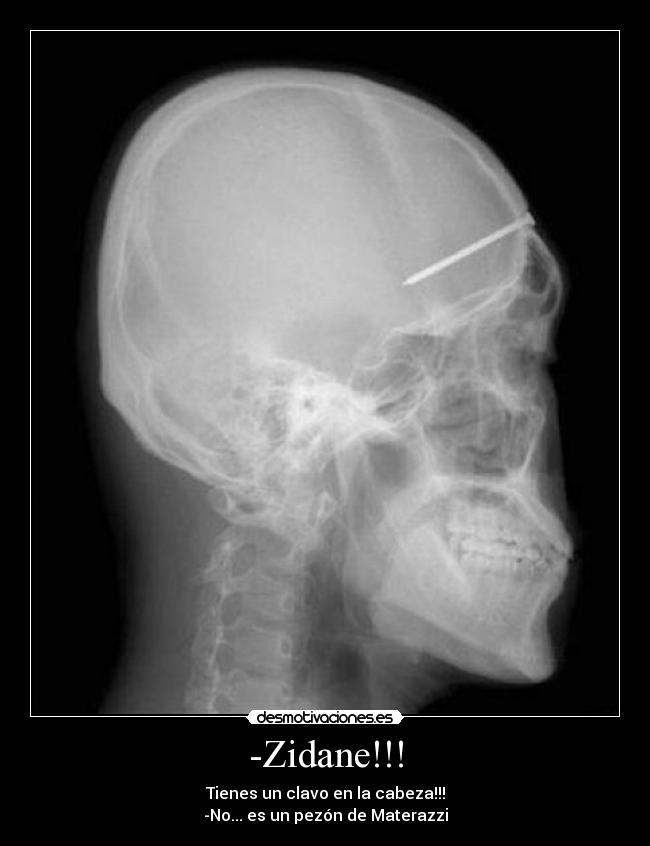 -Zidane!!! - Tienes un clavo en la cabeza!!!
-No... es un pezón de Materazzi