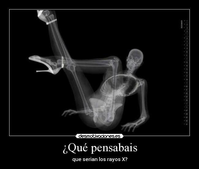 ¿Qué pensabais - que serian los rayos X?