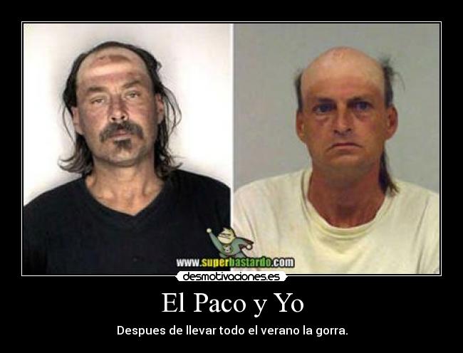 El Paco y Yo - Despues de llevar todo el verano la gorra.