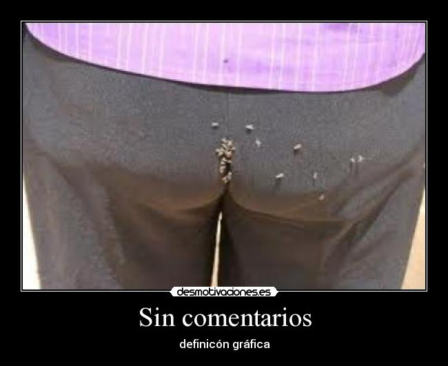 Sin comentarios -