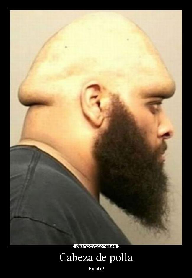 Cabeza de polla - 