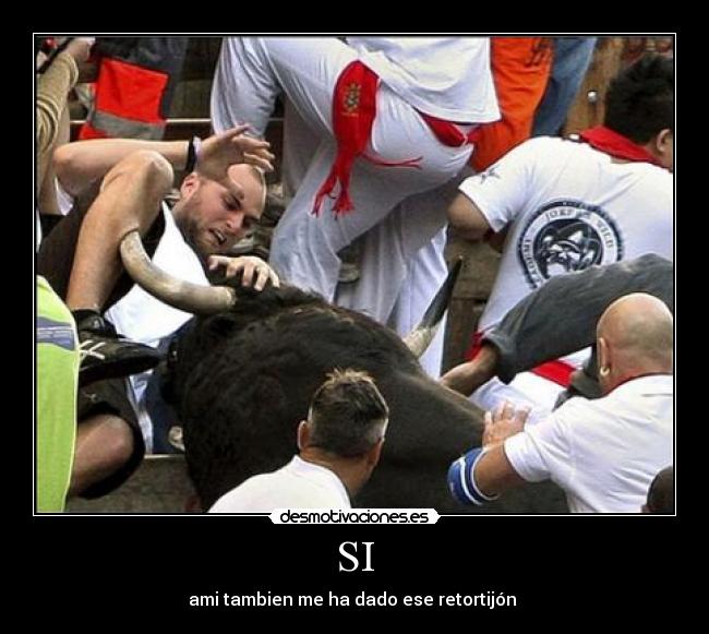 SI - ami tambien me ha dado ese retortijón