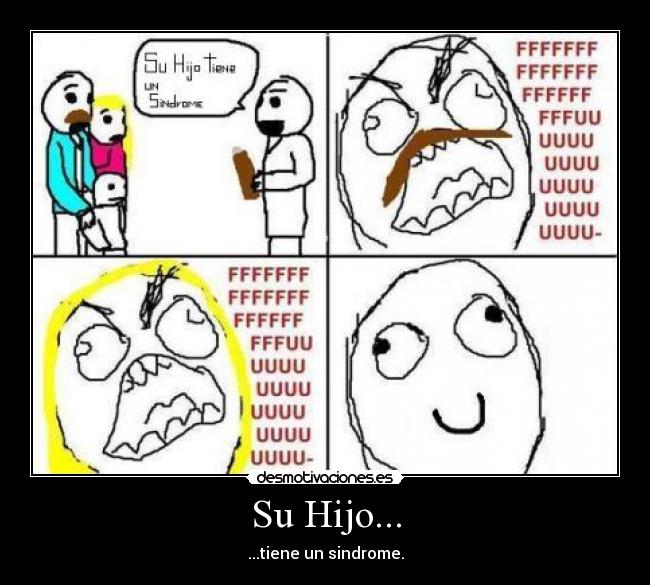 Su Hijo... - ...tiene un sindrome.