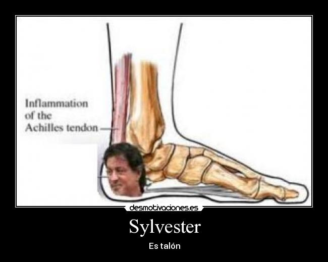 Sylvester - Es talón