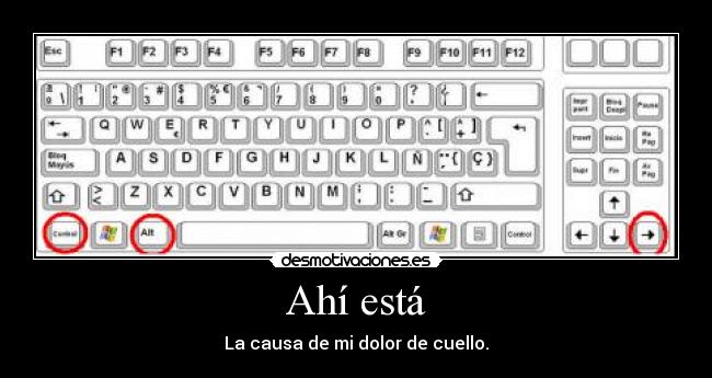 Ahí está - La causa de mi dolor de cuello.