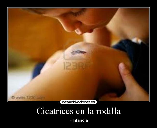 Cicatrices en la rodilla - = Infancia