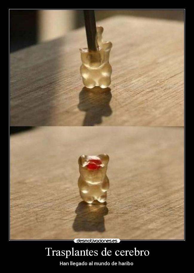 Trasplantes de cerebro - Han llegado al mundo de haribo 