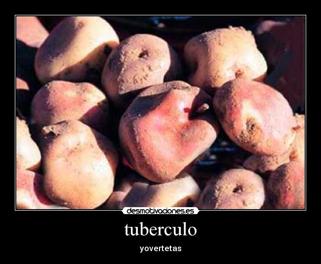 tuberculo - 