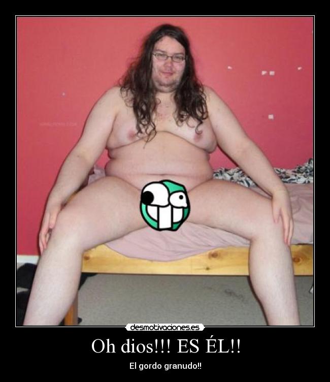 Oh dios!!! ES ÉL!! - El gordo granudo!!