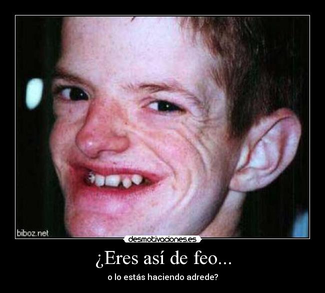 ¿Eres así de feo... - 