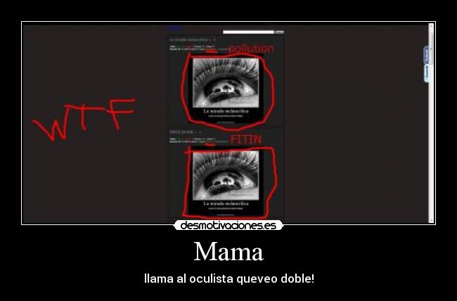 Mama - llama al oculista queveo doble!