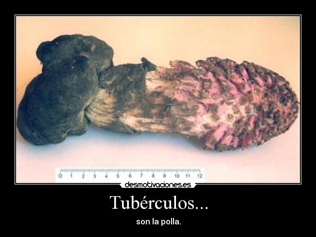 Tubérculos... - son la polla.