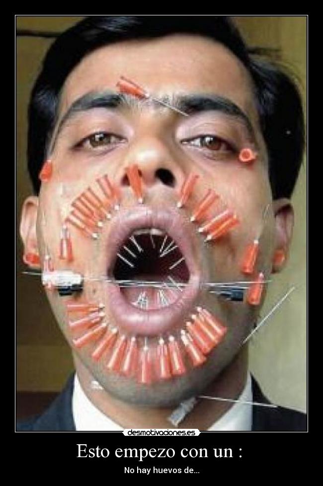 Esto empezo con un :  - 