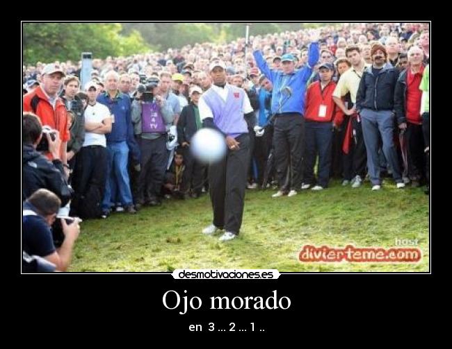 Ojo morado - en 3 ... 2 ... 1 ..