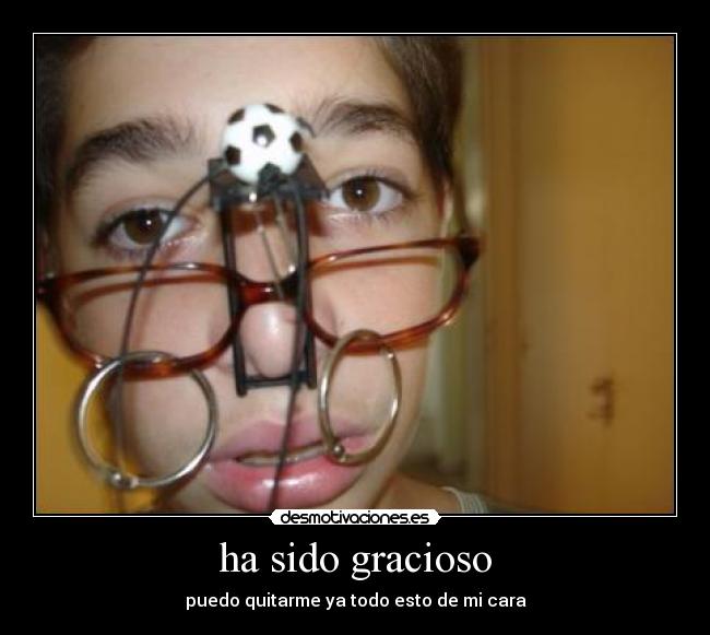 ha sido gracioso -