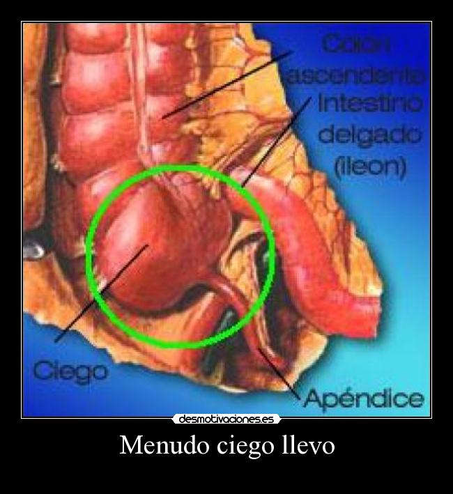 Menudo ciego llevo -