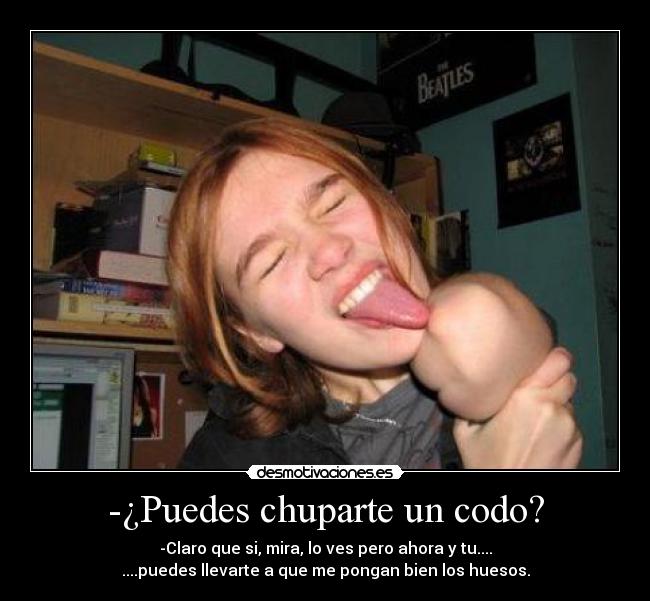-¿Puedes chuparte un codo? - -Claro que si, mira, lo ves pero ahora y tu....
....puedes llevarte a que me pongan bien los huesos.