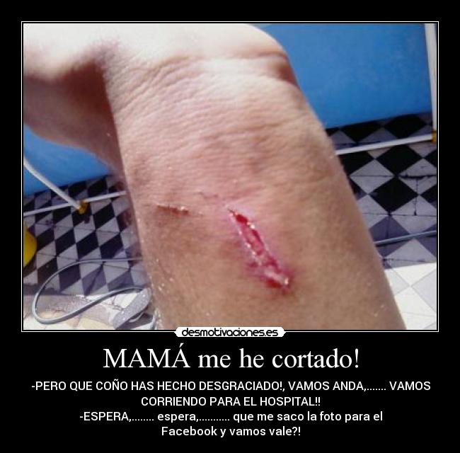 MAMÁ me he cortado! - -PERO QUE COÑO HAS HECHO DESGRACIADO!, VAMOS ANDA,....... VAMOS
CORRIENDO PARA EL HOSPITAL!!
-ESPERA,........ espera,........... que me saco la foto para el
Facebook y vamos vale?!