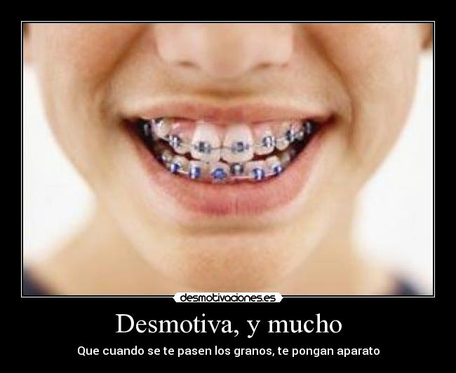 Desmotiva, y mucho - Que cuando se te pasen los granos, te pongan aparato