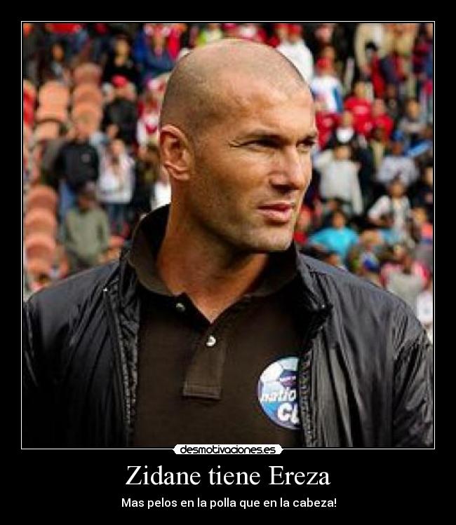 Zidane tiene Ereza - Mas pelos en la polla que en la cabeza!