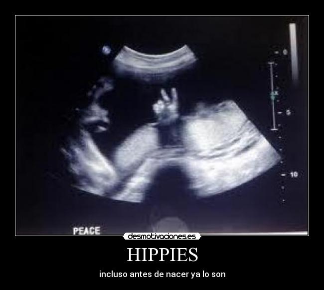 HIPPIES -