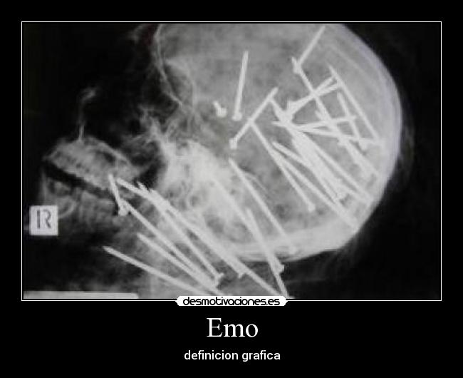 Emo - 