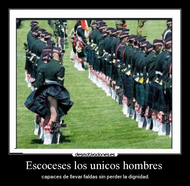Escoceses los unicos hombres -