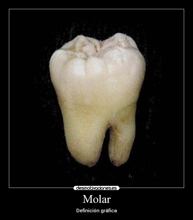 Molar - 