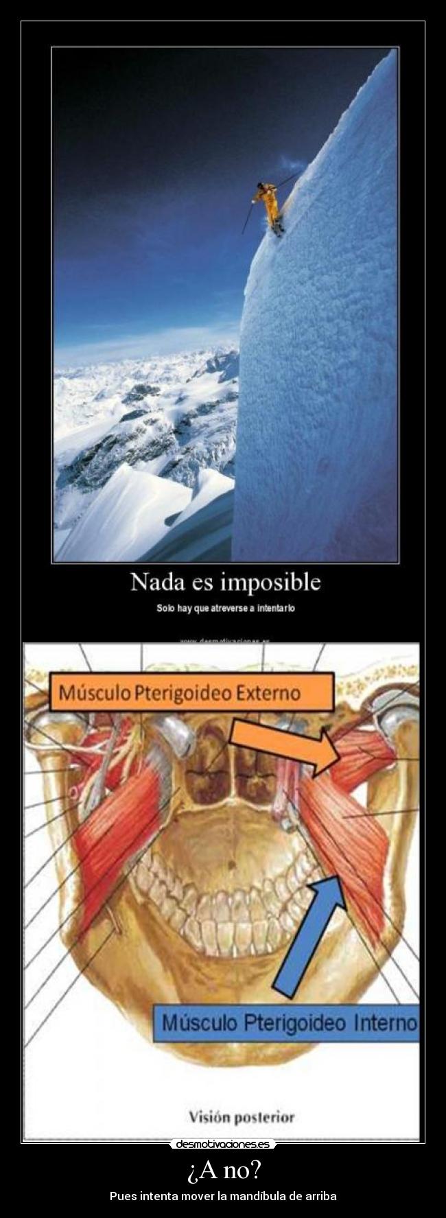 ¿A no? - Pues intenta mover la mandíbula de arriba