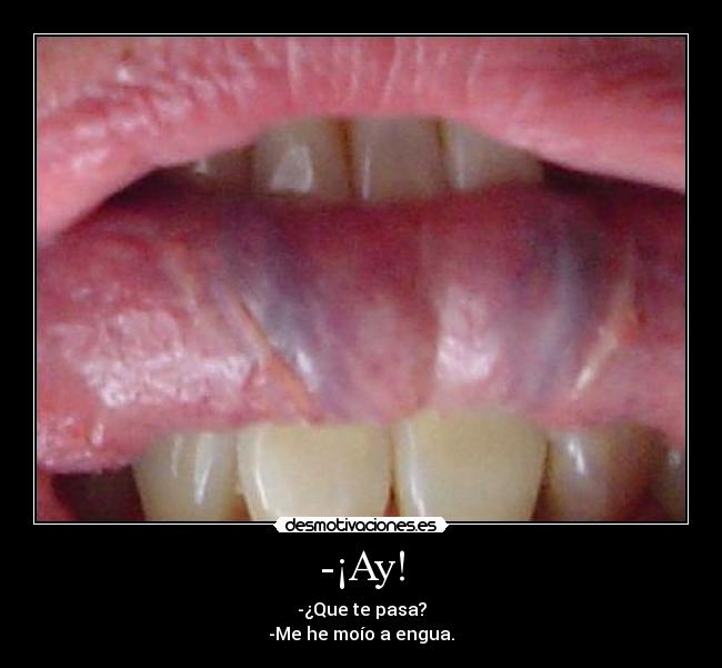 -¡Ay! - 