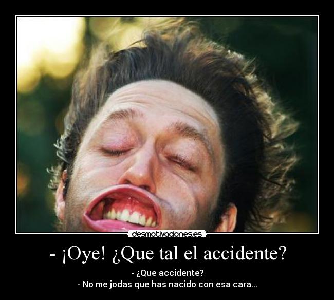 - ¡Oye! ¿Que tal el accidente? - 