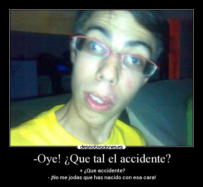-Oye! ¿Que tal el accidente? -
