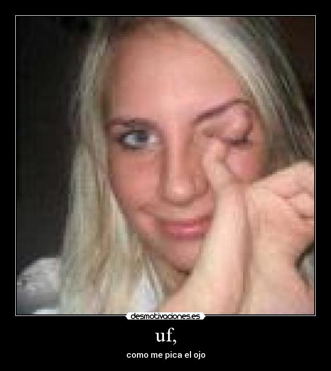 uf, - como me pica el ojo