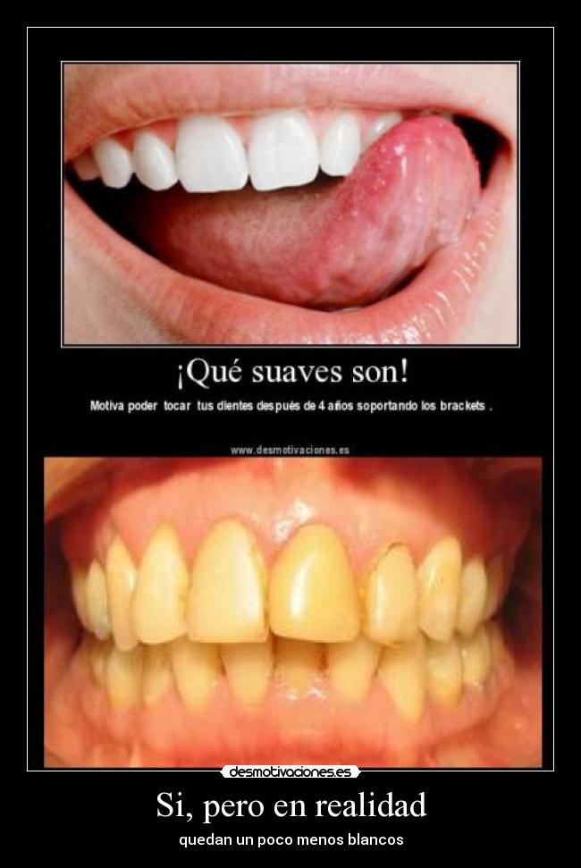 carteles dientes desmotivaciones