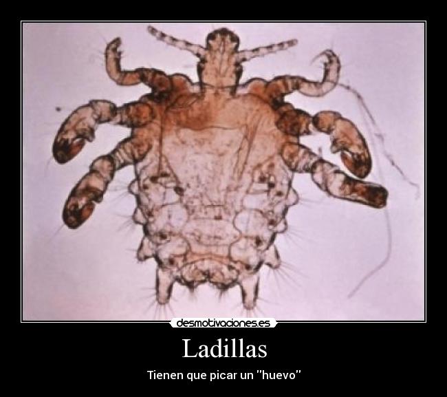 Ladillas - Tienen que picar un huevo