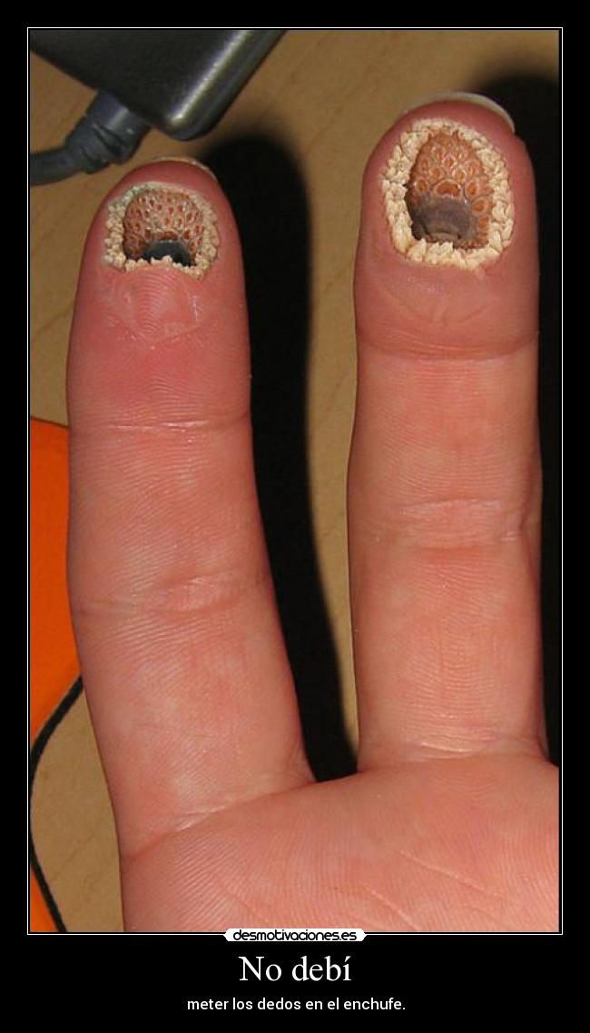 No debí - meter los dedos en el enchufe.