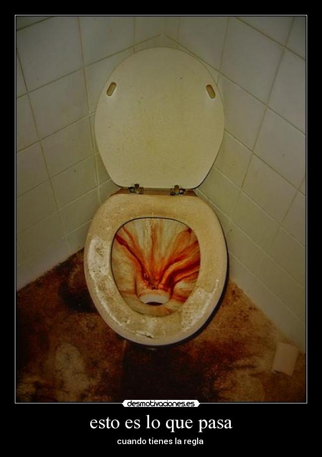 esto es lo que pasa -