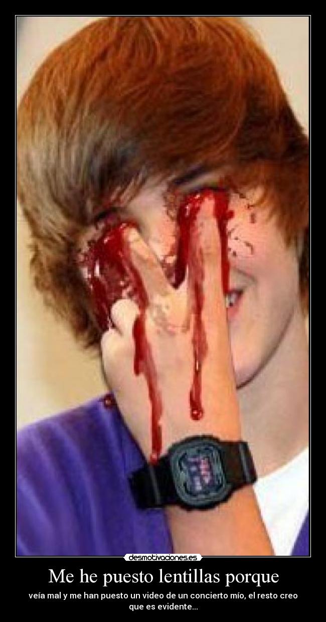Me he puesto lentillas porque - veía mal y me han puesto un video de un concierto mío, el resto creo que es evidente...
