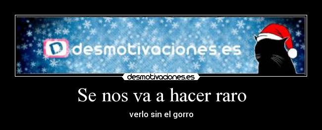 Se nos va a hacer raro - verlo sin el gorro