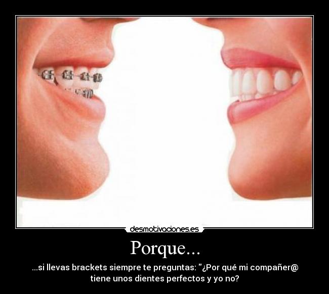 Porque... -