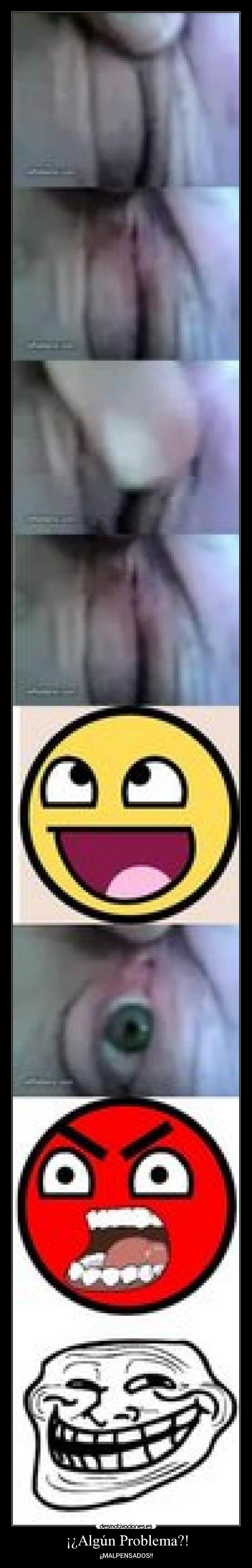 ¡¿Algún Problema?! - ¡¡MALPENSADOS!!