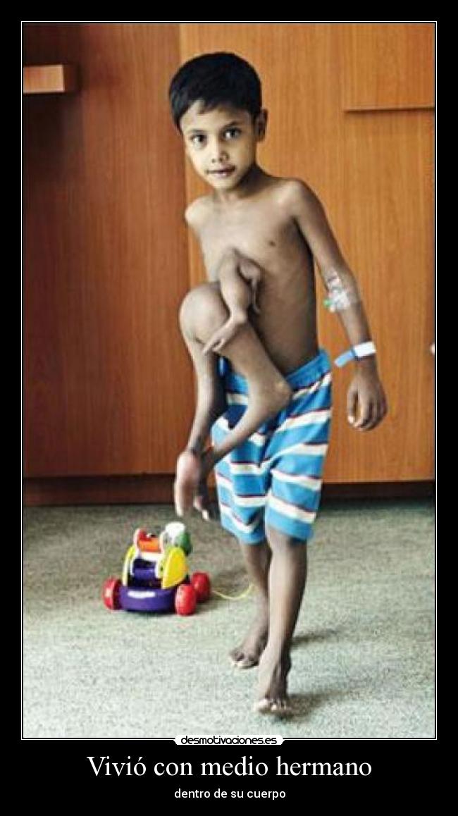 Vivió con medio hermano -