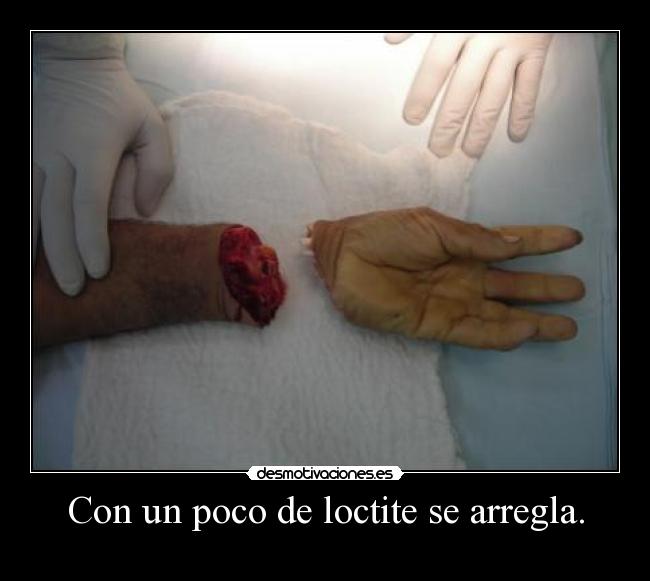 Con un poco de loctite se arregla. -