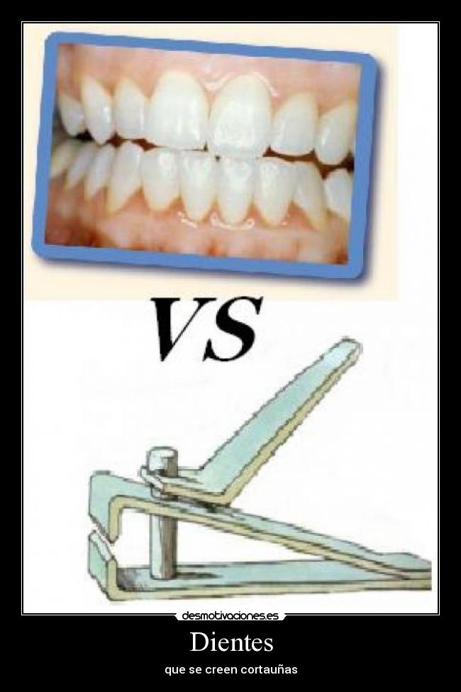 Dientes - 