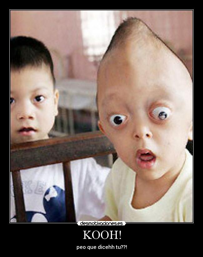 KOOH! - peo que dicehh tu??!