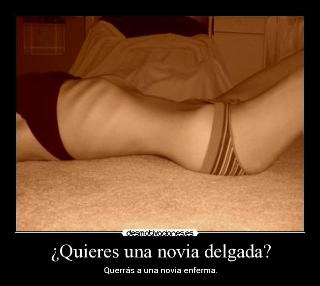 ¿Quieres una novia delgada? - Querrás a una novia enferma.