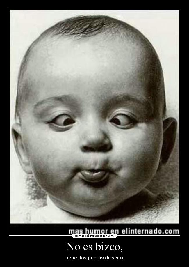 No es bizco, -